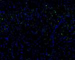 Calretinin Antibody in Immunohistochemistry (Frozen) (IHC (F))