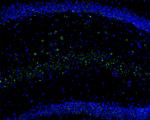 Calretinin Antibody in Immunohistochemistry (Frozen) (IHC (F))