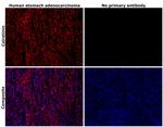 Calretinin Antibody in Immunohistochemistry (Paraffin) (IHC (P))