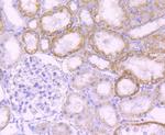 MMP3 Antibody in Immunohistochemistry (Paraffin) (IHC (P))