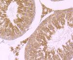 WNT2B Antibody in Immunohistochemistry (Paraffin) (IHC (P))