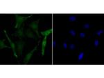 Phospho-CREB (Ser133) Antibody in Immunocytochemistry (ICC/IF)