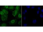 Phospho-CREB (Ser133) Antibody in Immunocytochemistry (ICC/IF)