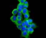 VAMP1 Antibody in Immunocytochemistry (ICC/IF)