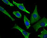 VAMP1 Antibody in Immunocytochemistry (ICC/IF)