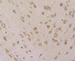 VAMP1 Antibody in Immunohistochemistry (Paraffin) (IHC (P))