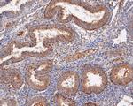 Placental Alkaline Phosphatase Antibody in Immunohistochemistry (Paraffin) (IHC (P))