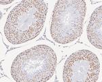 GTF2F2 Antibody in Immunohistochemistry (Paraffin) (IHC (P))