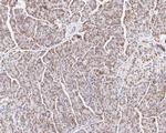 GTF2I Antibody in Immunohistochemistry (Paraffin) (IHC (P))