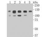 GTF2I Antibody in Western Blot (WB)