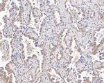 UBE4B Antibody in Immunohistochemistry (Paraffin) (IHC (P))