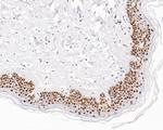 EXOSC7 Antibody in Immunohistochemistry (Paraffin) (IHC (P))