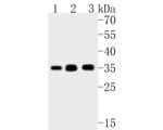 EXOSC7 Antibody in Western Blot (WB)