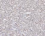 TRMT2A Antibody in Immunohistochemistry (Paraffin) (IHC (P))