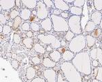 TRMT2A Antibody in Immunohistochemistry (Paraffin) (IHC (P))