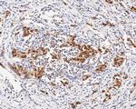 TRMT2A Antibody in Immunohistochemistry (Paraffin) (IHC (P))