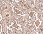 CARS Antibody in Immunohistochemistry (Paraffin) (IHC (P))