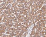 FADS1 Antibody in Immunohistochemistry (Paraffin) (IHC (P))