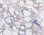 FADS1 Antibody in Immunohistochemistry (Paraffin) (IHC (P))