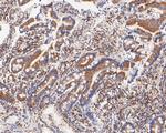 FADS1 Antibody in Immunohistochemistry (Paraffin) (IHC (P))