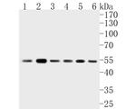 FADS1 Antibody in Western Blot (WB)