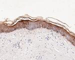 SERPINB3 Antibody in Immunohistochemistry (Paraffin) (IHC (P))