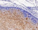 SERPINB3 Antibody in Immunohistochemistry (Paraffin) (IHC (P))