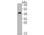 SERPINB3 Antibody in Western Blot (WB)