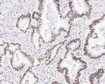 NAT10 Antibody in Immunohistochemistry (Paraffin) (IHC (P))