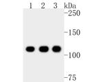 NAT10 Antibody in Western Blot (WB)