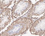 GATAD2A Antibody in Immunohistochemistry (Paraffin) (IHC (P))