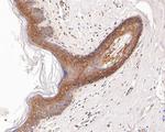 Desmocollin 3 Antibody in Immunohistochemistry (Paraffin) (IHC (P))