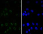 CtBP2 Antibody in Immunocytochemistry (ICC/IF)