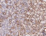 CtBP2 Antibody in Immunohistochemistry (Paraffin) (IHC (P))