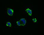 PAK1 Antibody in Immunocytochemistry (ICC/IF)