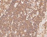 PAK1 Antibody in Immunohistochemistry (Paraffin) (IHC (P))