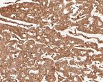 PAK1 Antibody in Immunohistochemistry (Paraffin) (IHC (P))