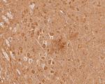 PAK1 Antibody in Immunohistochemistry (Paraffin) (IHC (P))