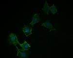 ACSL4 Antibody in Immunocytochemistry (ICC/IF)