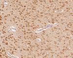 ACSL4 Antibody in Immunohistochemistry (Paraffin) (IHC (P))