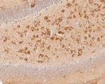 ACSL4 Antibody in Immunohistochemistry (Paraffin) (IHC (P))