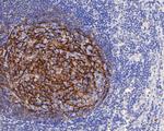 CD21 Antibody in Immunohistochemistry (Paraffin) (IHC (P))