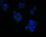AGTR1 Antibody in Immunocytochemistry (ICC/IF)