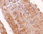 Actin Antibody in Immunohistochemistry (Paraffin) (IHC (P))