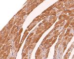 Actin Antibody in Immunohistochemistry (Paraffin) (IHC (P))