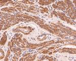 Actin Antibody in Immunohistochemistry (Paraffin) (IHC (P))