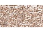 Actin Antibody in Immunohistochemistry (Paraffin) (IHC (P))