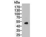 Thymidine Phosphorylase Antibody in Western Blot (WB)