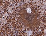 p47phox Antibody in Immunohistochemistry (Paraffin) (IHC (P))