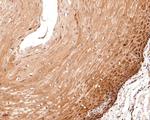 eIF6 Antibody in Immunohistochemistry (Paraffin) (IHC (P))